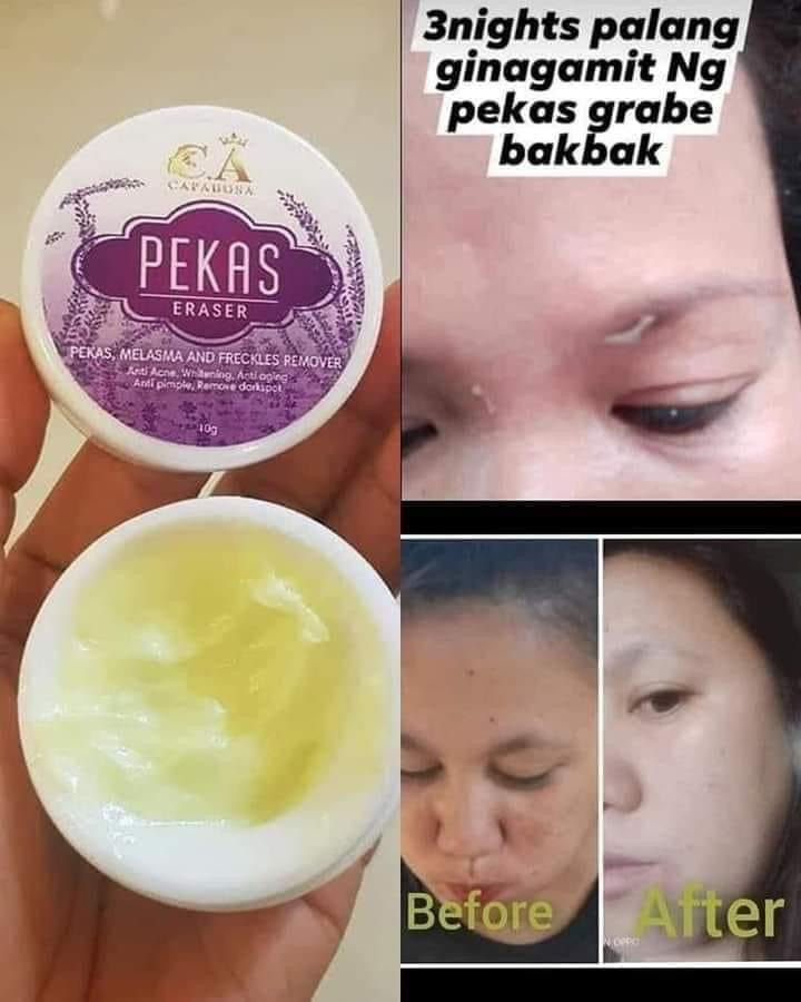 Thumbnail: Capadosa Pekas,Melasma,Acne,Pimple and Freckles Remover