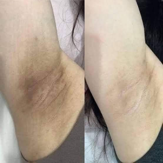 Thumbnail: GMEELAN Sakura Gluta Brightening 50x Booster Armpit Underarm Cream 30G