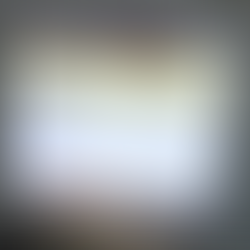 Candela Gentle Max / Lase PRO Fault 7.5