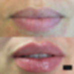 Fresh, Naturally Fuller Lips