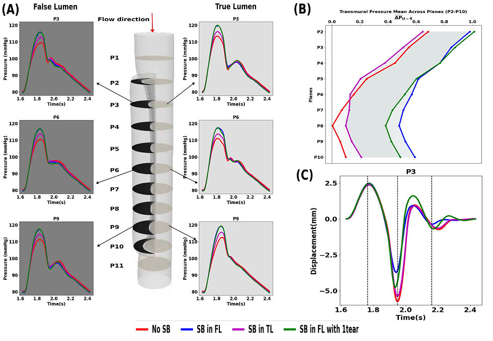 Fig 2: Panel (A) shows pressure variation for all cases across multiple planes in the dissection for TL and FL. Panel (B) shows the pressure difference between TL and FL across all planes and Panel (C) shows the displacement at P3 for all cases.