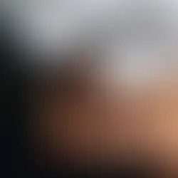 Understanding End-Stage Kidney Disease (ESKD) in the African American Community