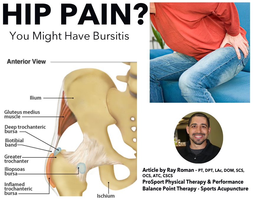 Hip Pain Bursitis Symptoms