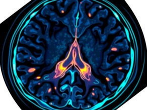 Imaging and Pathology