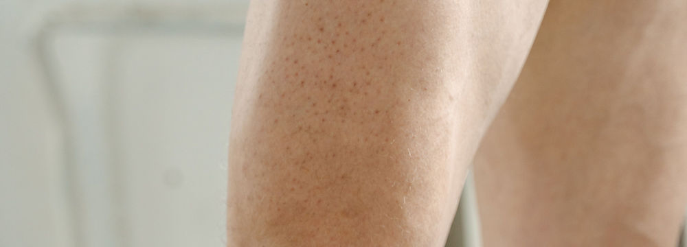 Epilation Cuisses Homme