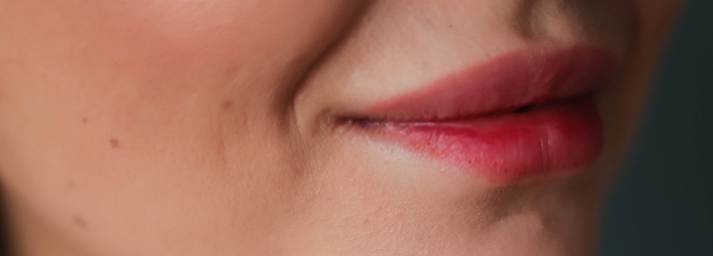 Epilation Joues + lèvre + menton Femme
