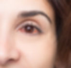 eye care