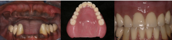 Jung Dental Implant center