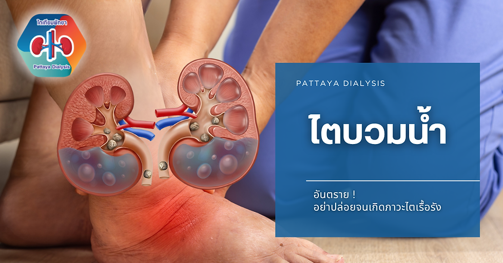 ไตบวมน้ำ อันตรายแค่ไหน? สาเหตุ อาการ และวิธีรักษาที่ควรรู้