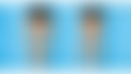 Working with Bow legs and Knock Knees