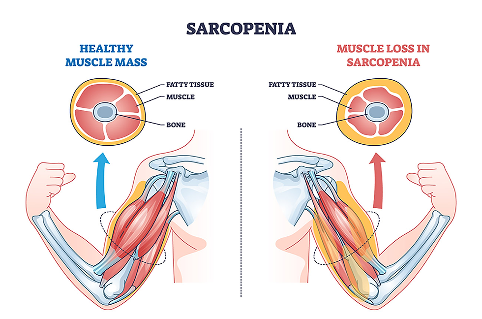 a diagram about sarcopenia