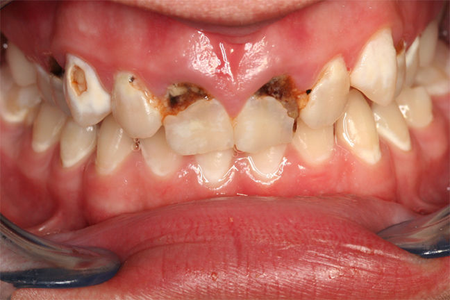 Patient 9 Before