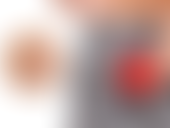 The Rising Popularity of Laser Pilonidal Sinus Treatment in Ahmedabad: Here’s Why