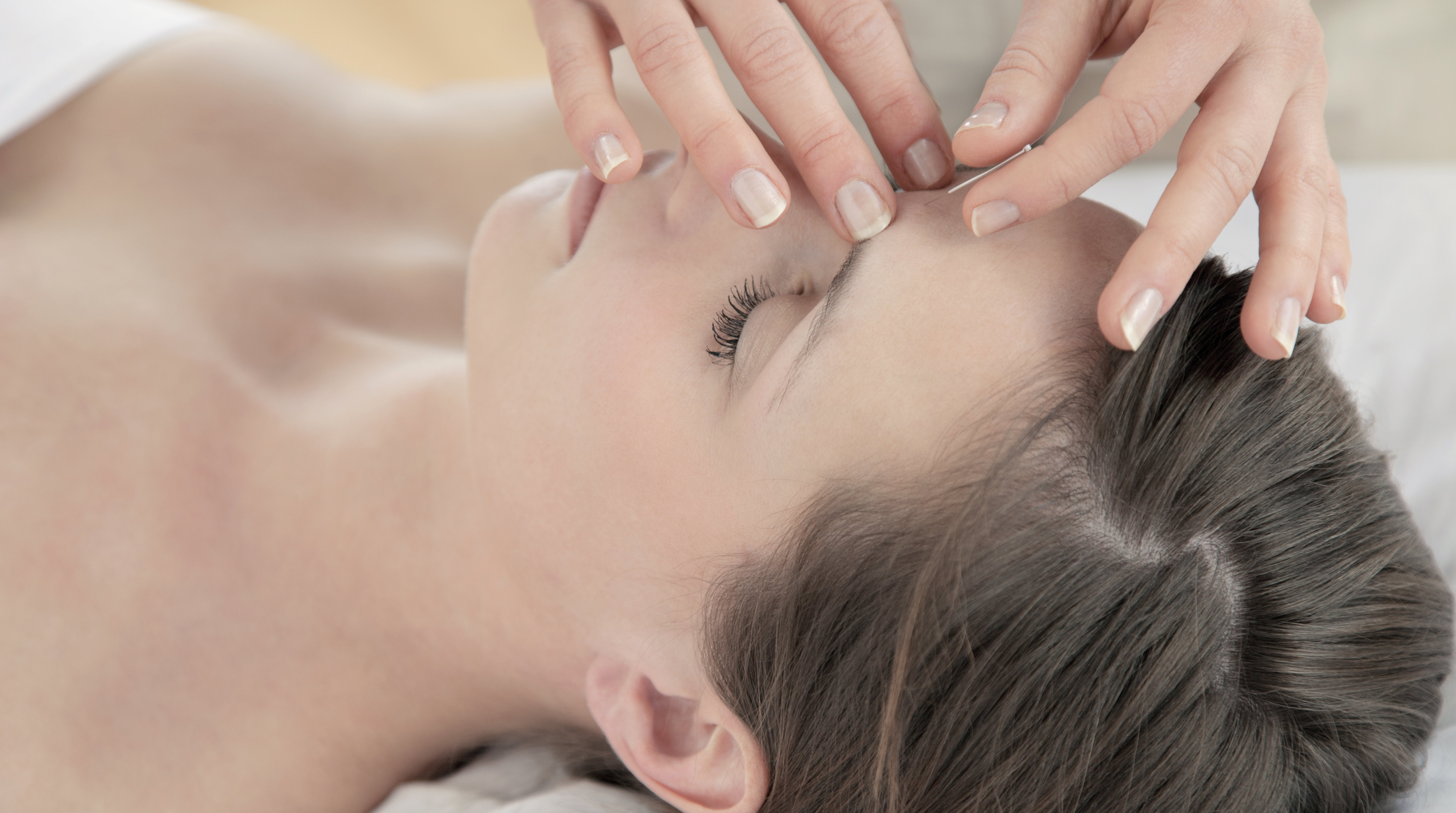 Facial Acupuncture / Cosmetic Acupuncture NW3 2BE