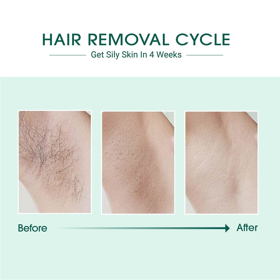 Thumbnail: Laser IPL Hair Removal