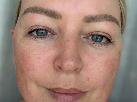 The CurrentBody Series 2 LED Mask: My Honest Experience