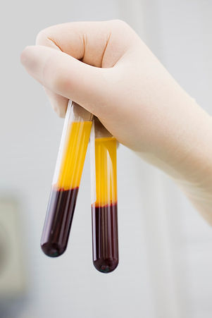 prp kezelés.jpg