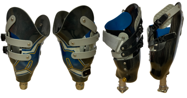 Martin Bionics Socket-Less Socket