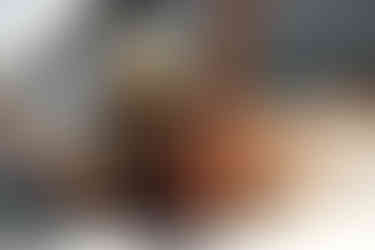 Active Amputee after visit with Cornerstone