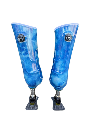 Cornerstone created blue stubbies for a double amputee patient
