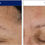 Миниатюра: NEOSTRATA Firming Retinol Complex סרום רטינול נאוסטרטה