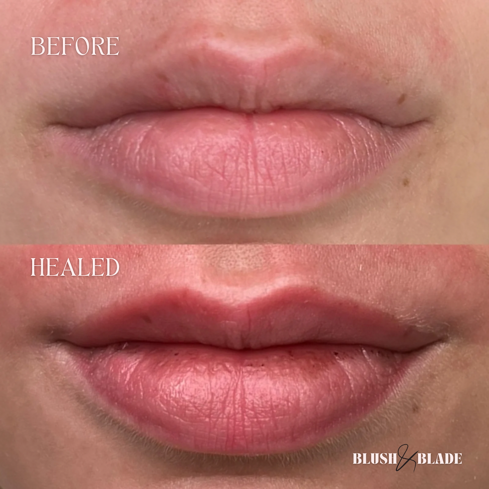 HEALED LIP BLUSH
