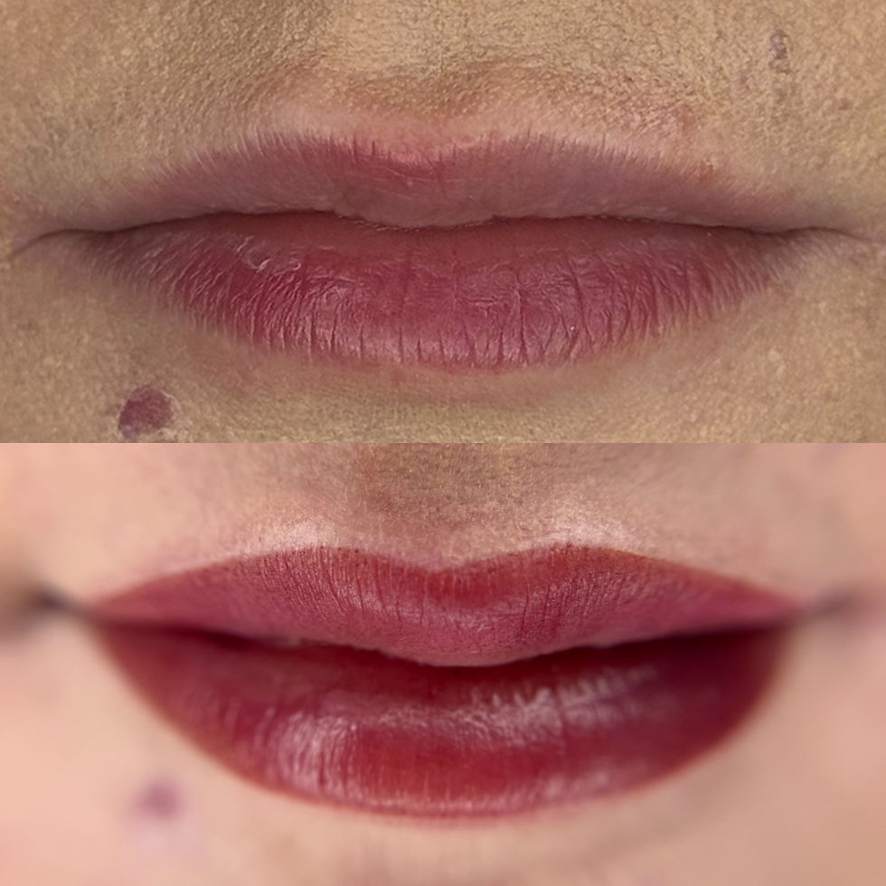 Immediately After Lip Blush