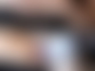 The Benefits Of Morpheus8 For Skin Tightening