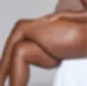 client_treatment_thighs.webp
