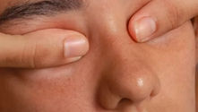 woman covering her eyes