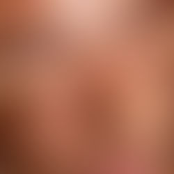 woman covering her eyes