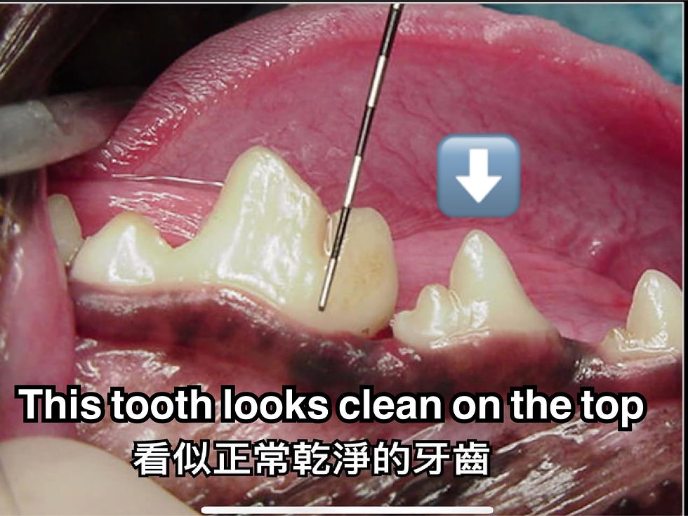 看似正常的牙齒