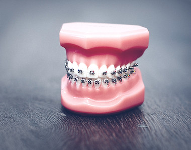 Orthodontics: Adults Dr Andries Ferreira