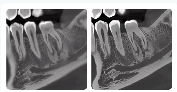 Miniatura: D50 2-in-1 CBCT -FUSSEN
