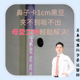 1公分鼻腔異物輕鬆用母愛之吻解決