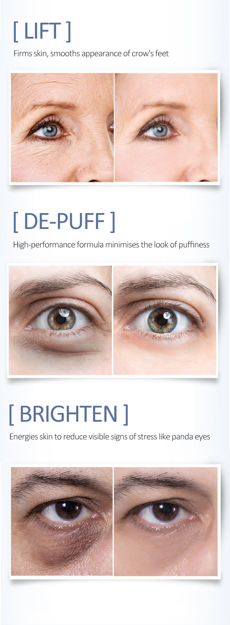 Thumbnail: Belizza Ocheal Anti-Fatigue & Brightening Eye Cream