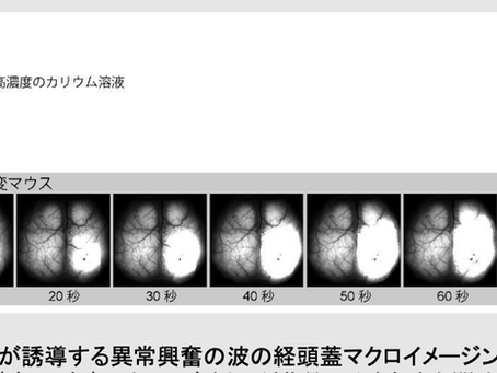 中枢性疲労と皮質拡延性抑制