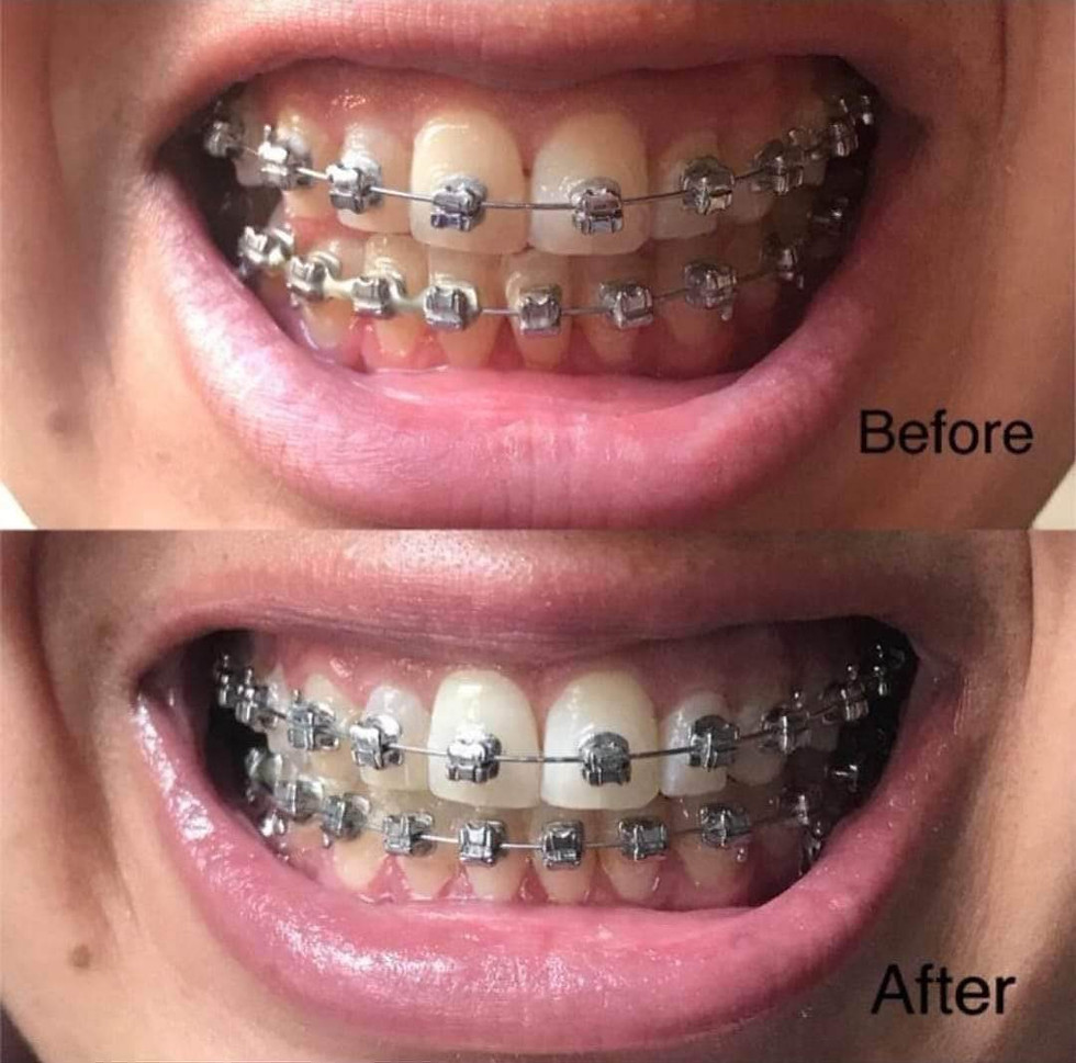 Thumbnail: AP24 Whitening Toothpaste 
