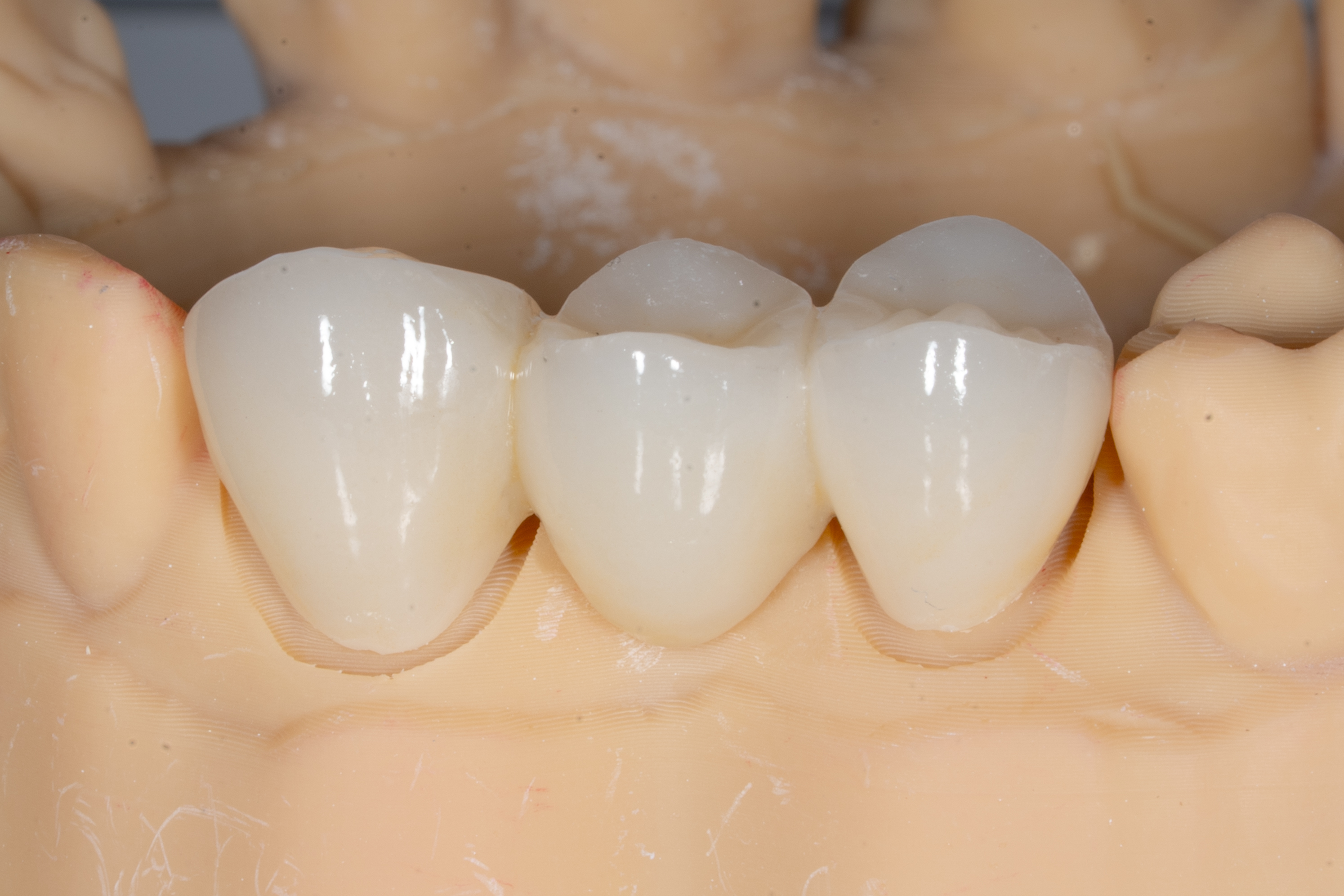 Materials - Zirconia.jpg