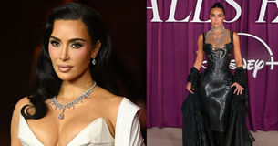 Kim Kardashian y el estrés: Le diagnosticaron un aneurisma cerebral