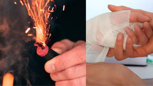 Venta ilegal de pólvora y alarma por cifras de quemados: Subdirector de INS dio detalles del tema