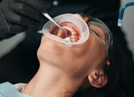South Brisbane Dentists