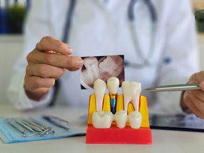 Dental professional examines tooth model and X-ray to assess patient condition and treatment options
