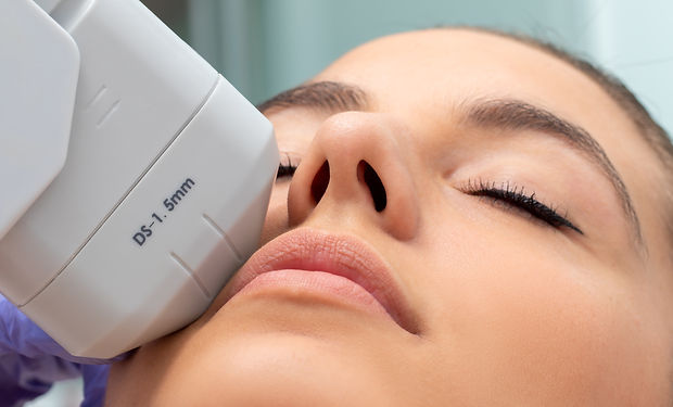 Extreme close up of HIFU treatment on female face. Therapist doing cosmetic plasma lift wi