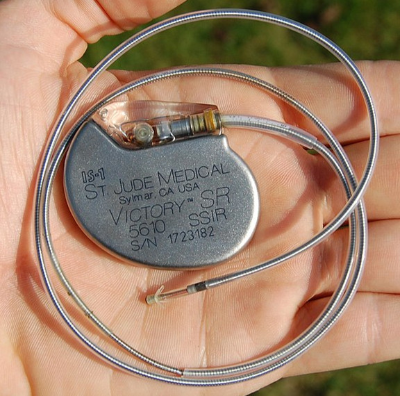 Walkman Pacemaker Your Pacemaker Journey: From Pre-Op to Full Recovery – A Comprehensive ...