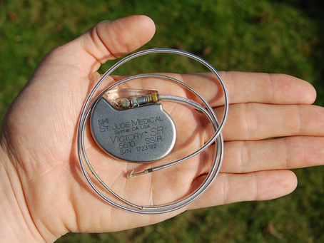 Your Pacemaker Journey: From Pre-Op to Full Recovery – A Comprehensive Guide