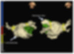 Radiofrequency pulmonary vein isolation for af ablation