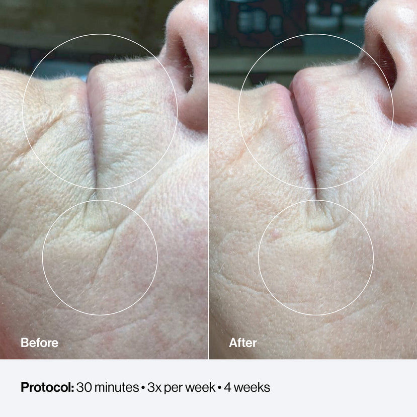 Miniatura: Celluma® FACE