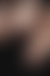 ยูเอ็นประกาศ "การเฝ้าระวังทั่วโลก" หลังพบไวรัสใหม่ในโรงเชือดหมูที่บราซิล