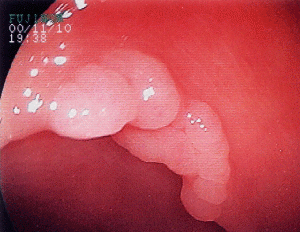 tun4-300x232.gif